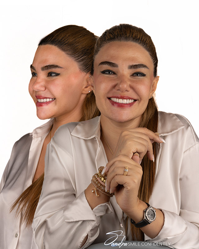 لمینت سرامیکی برای اصلاح دیاستم