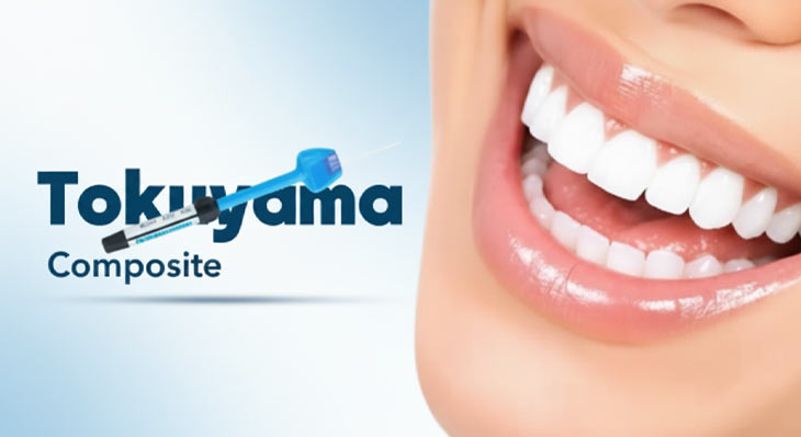 کامپوزیت توکویاما چیست؟